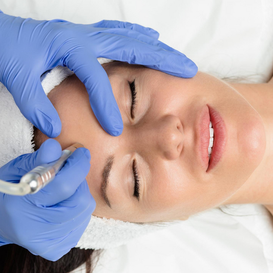 Diamond Microdermabrasion with Chemical Peel