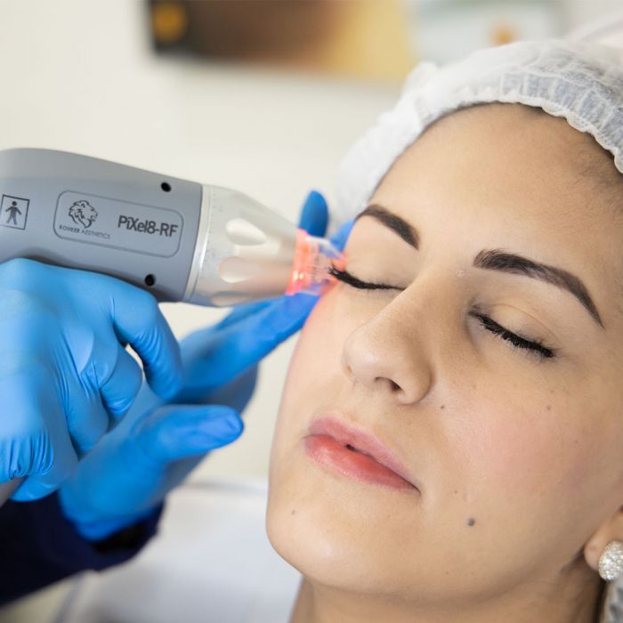 Pixel 8 RF Microneedling