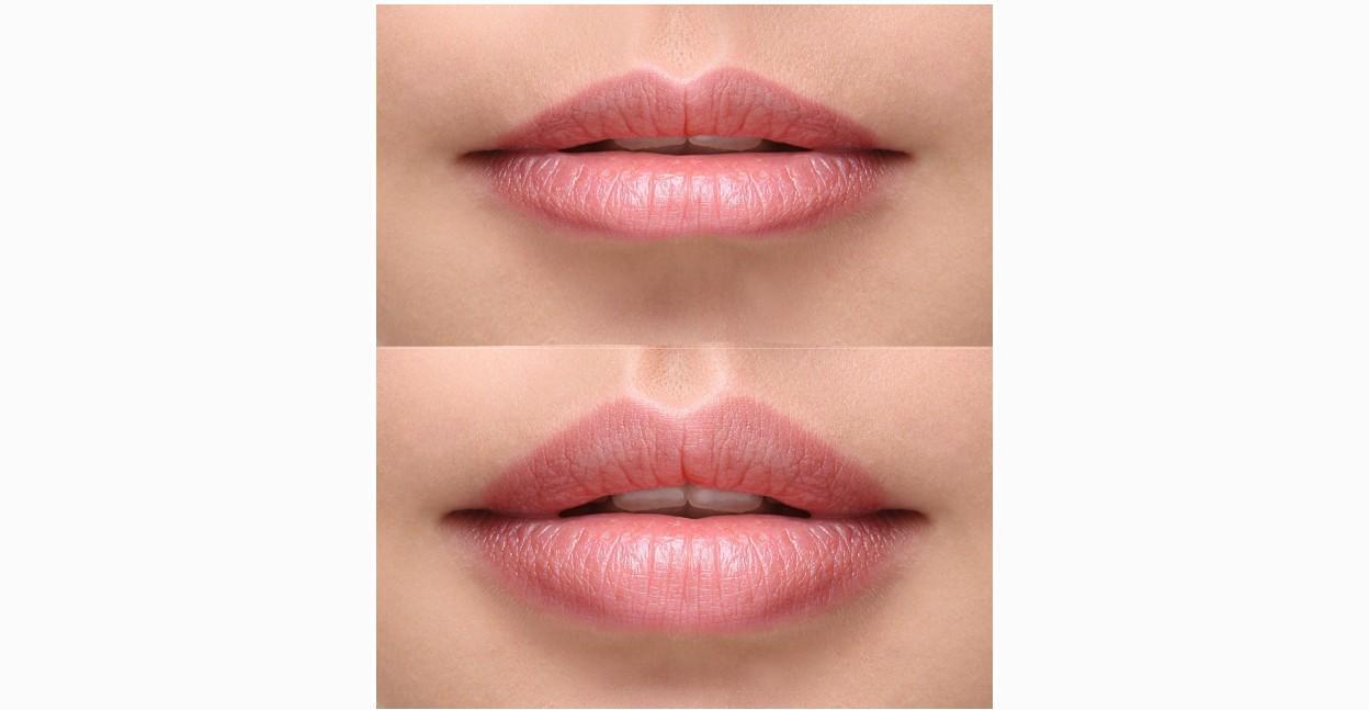 Lip Flip