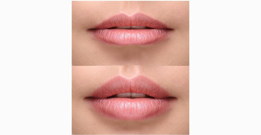 Lip Flip