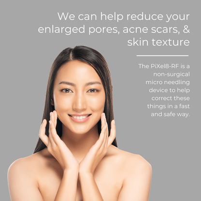 Pixel8 RF Microneeling Packages for Face Only  - Package of 3