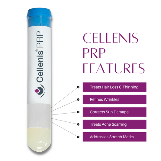 Liquid Gold (PRP) Injections