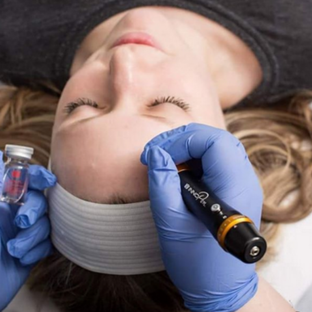 Microneedling - 3 Sessions