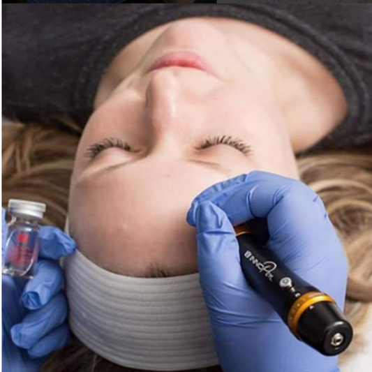 Microneedling Package of 6 for Hair Restoration - 20% OFF