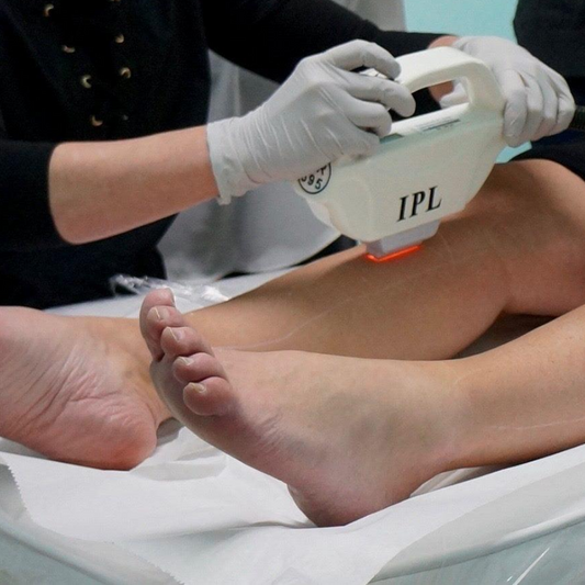 IPL Hair Removal - 6 sessions for 1 Medium Area